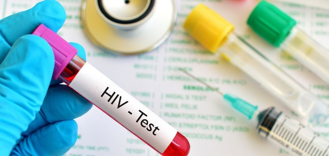 How accurately can the blood screening test detect HIV? - Diagnear