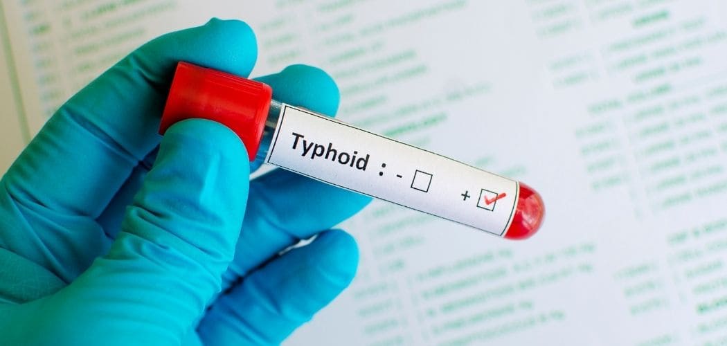 What Do Typhoid IgG and IgM Positive Mean In tests? - Diagnear