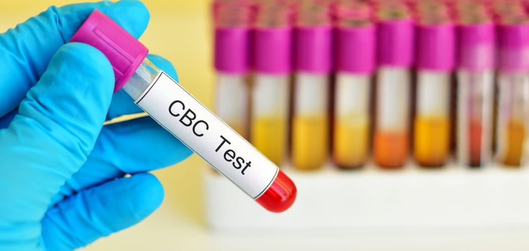 What is the use of a CBC blood test? - Diagnear