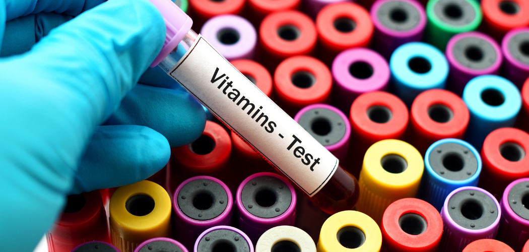 WHY IS A VITAMIN TEST PACKAGE NECESSARY? - Diagnear