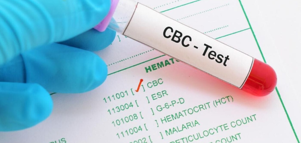 WHAT IS CBC TEST? - Diagnear