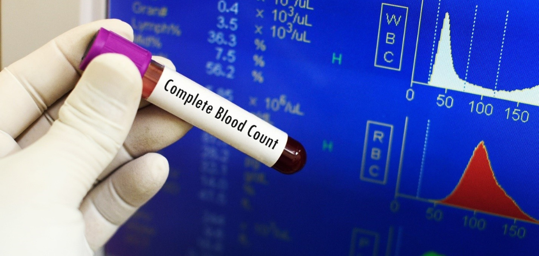 GUIDE TO COMPLETE BLOOD COUNT  - Diagnear