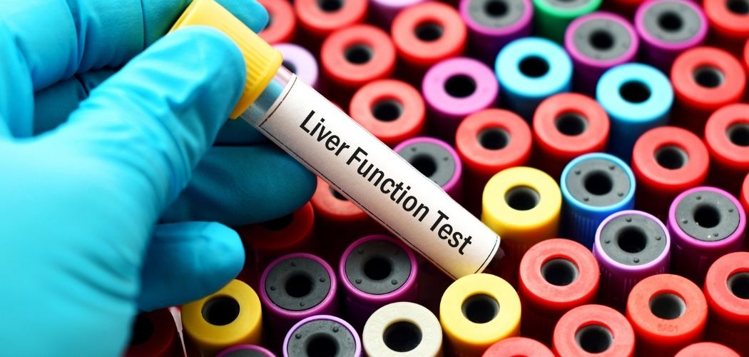 What is Liver Function Tests - Diagnear