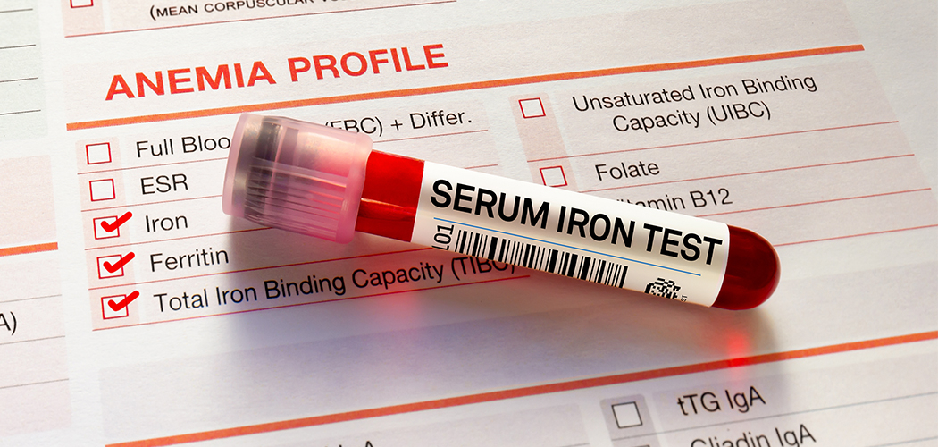 Iron Test: What It Is, Purpose, Procedure & Results Your Guide to Iron Tests - Diagnear