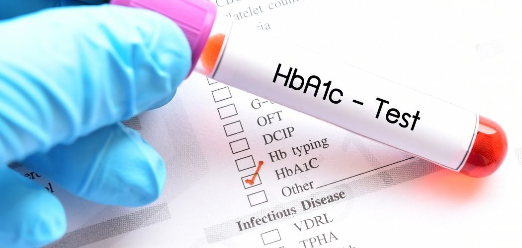 Importance of HbA1c Blood Test? - Diagnear